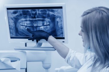 Kız dişçi radyografideki hasta bir dişi işaret ediyor.