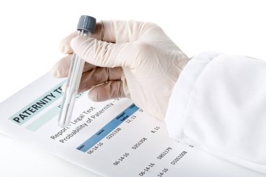 Babalık testi sonuç formu bukkal çubukla te içinde tutan doktor ile