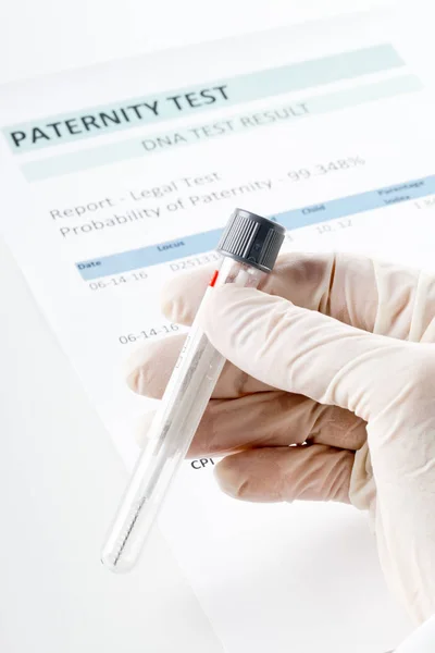 Форма результату тесту на батьківство з лікарем, який тримає буккальний мазок у прорах — стокове фото