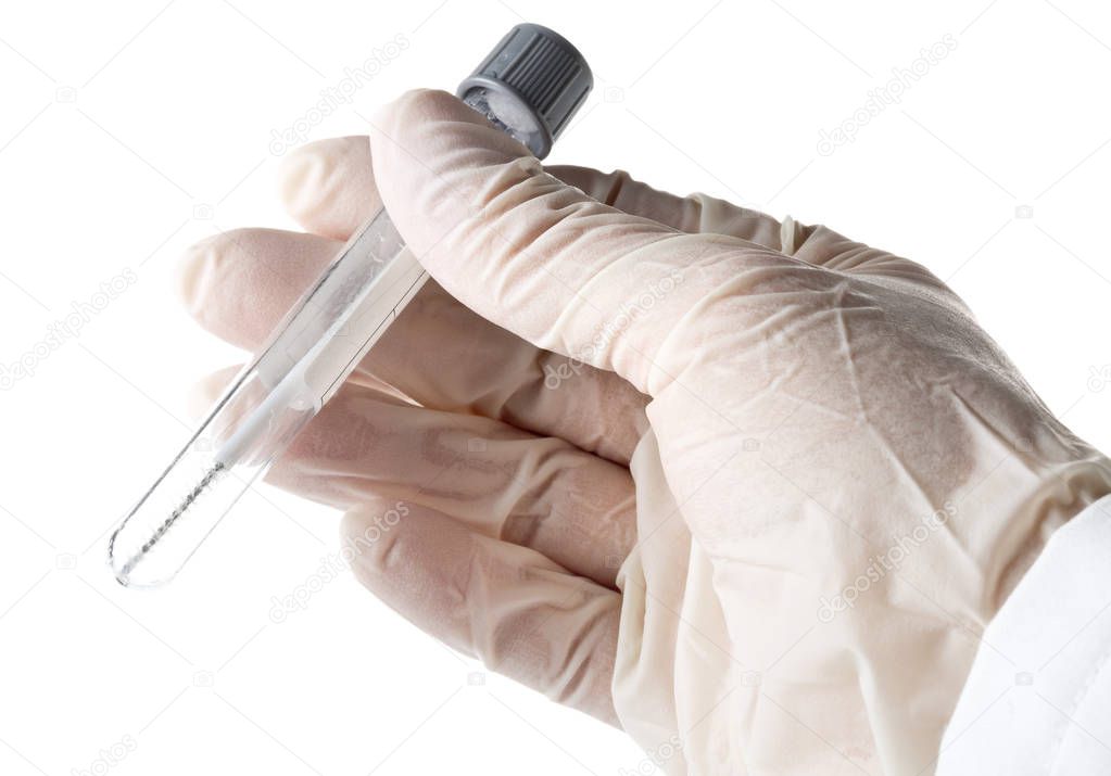 Paternity test - doctor holding buccal swab in test tube