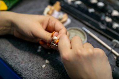 Takma diş düzeni. Teknisyen diş modelini parlatır. Diş laboratuarı, implantasyon..