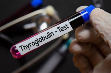 Tiroglobülin. Kan örneğiyle test metni. Üst görünüm siyah arkaplanda izole edildi. Sağlık / Tıbbi Konsept