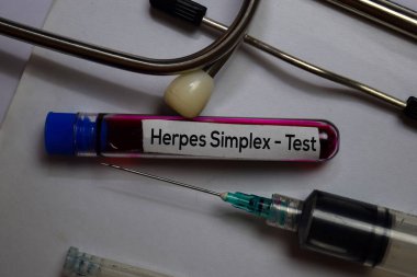 Herpes Simplex - Kan örneği ile test edin. Ofis masasında izole üst görünüm. Sağlık / Tıp kavramı
