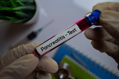 Pankreas iltihabı. Kan örneğiyle test edin. Üst görüntü ofis masasında izole edildi. Sağlık / Tıbbi Konsept