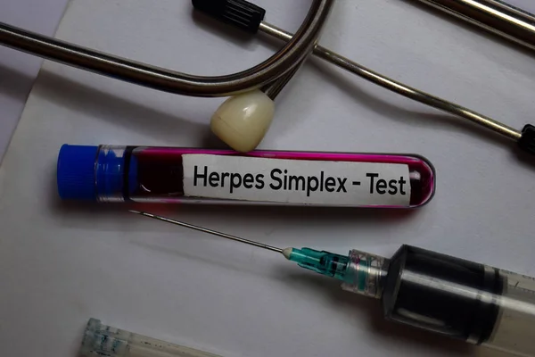 Herpes Simplex Kan Örneği Ile Test Edin Ofis Masasında Izole — Stok fotoğraf