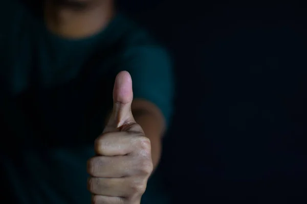 Jovem Mostrando Gesto Polegares Para Cima Dando Aprovação Sobre Fundo — Fotografia de Stock