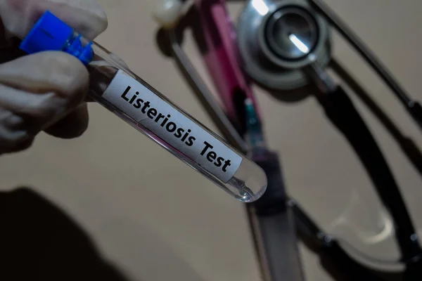 Listériose Vaccinale Test Isolé Sur Bureau Soins Santé Concept Médical — Photo