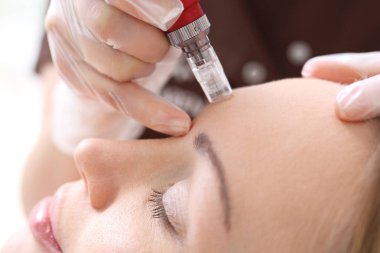 İğne Mezoterapi tedavisi estetik yürütülmesinde Güzellik Salonu