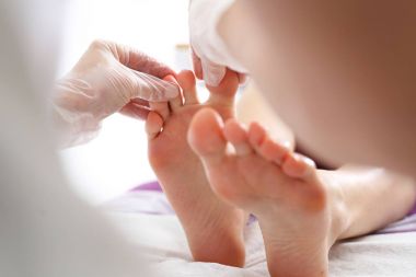Toe and nail fungus. Woman at a dermatologist. clipart