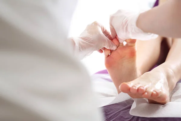 Teen en nagel schimmel. Vrouw bij een dermatoloog. — Stockfoto