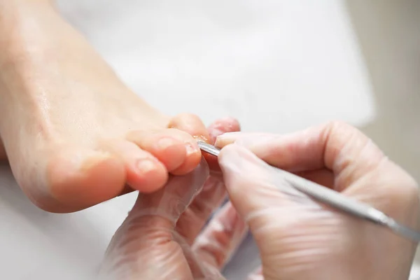 Podología, recorte de uñas a los pies . — Foto de Stock