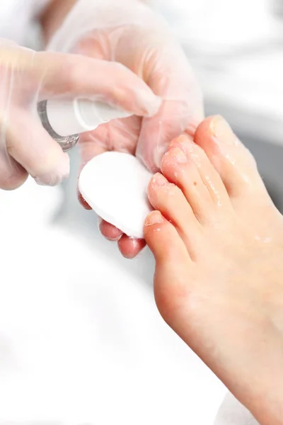 Podol, voorbereiding van voeten voor chirurgie — Stockfoto