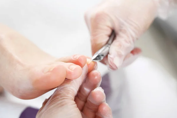 Podología, corte de pieles . — Foto de Stock