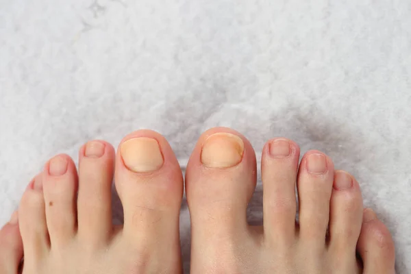 Pedicure. Nail care at the feet. — Stock Photo, Image