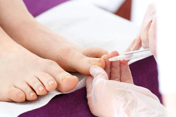 Injektion an den Zehen des Fußes — Stockfoto