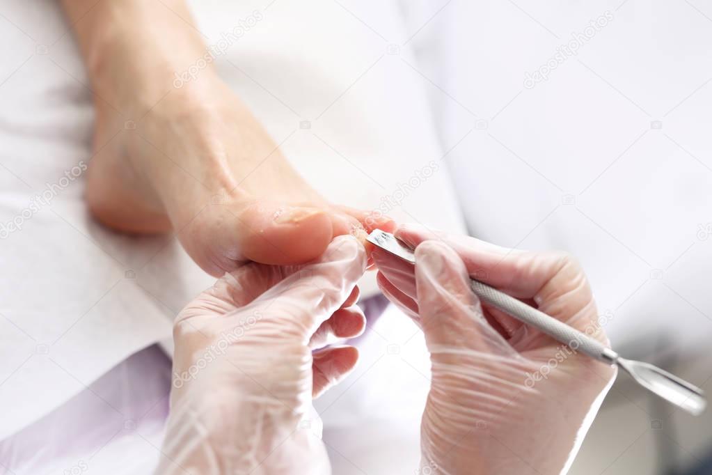Podology, Nail clipping at the feet.