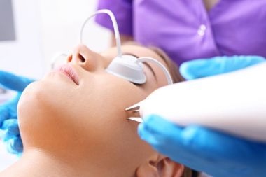 Lazer peeling, akne tedavisi.