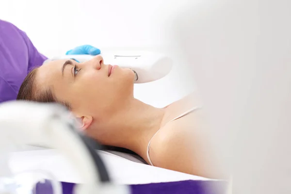 Peeling laser, trattamento dell'acne . — Foto Stock