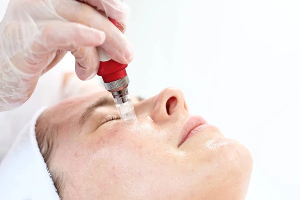 Nålen mesotherapy behandling estetisk utförande i skönhetssalongen — Stockfoto