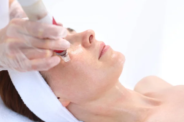 Nål Mesotherapy, ansiktslyft — Stockfoto