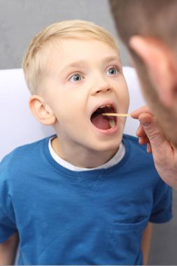 Bir çocuk hasta boğazında. Çocuk doktoru çocuğun gard denetler