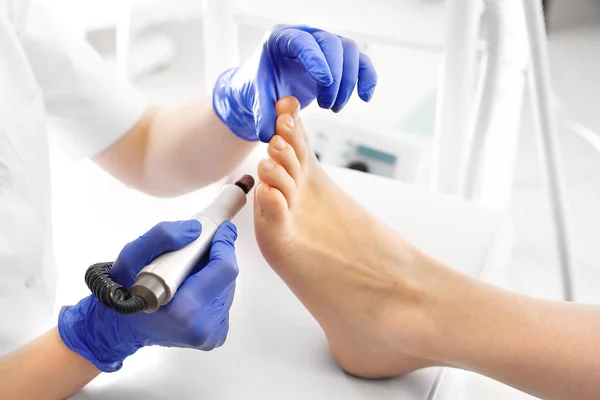 Pedicure Medico Rimuove Impronta Sul Piede Con Mugnaio — Foto Stock