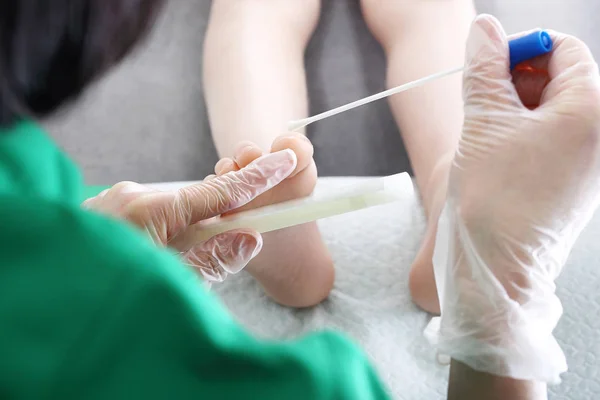 Micosis Los Pies Las Uñas Dermatólogo Toma Hisopo Del Clavo —  Fotos de Stock