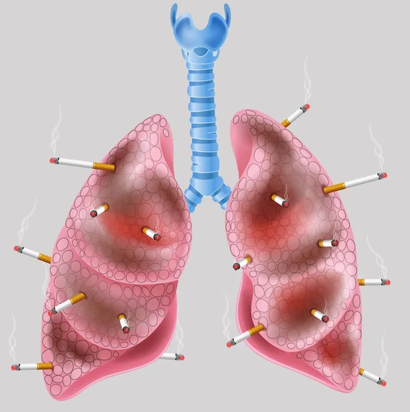 Ciğerde sigara var. — Stok Vektör