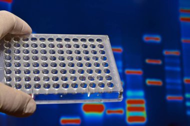 Dna genetik laboratuvarlarda test. 
