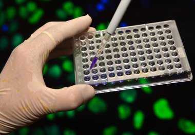 Dna genetik laboratuvarlarda test. 