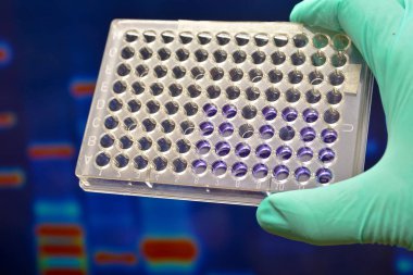 Dna testi laboratuvarda.