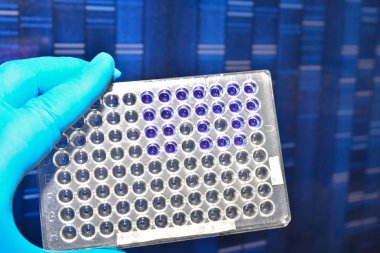 Dna testi laboratuvarda. 