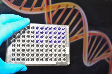 DNA testi. Genom araştırma.