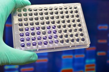 Dna testi laboratuvarda.