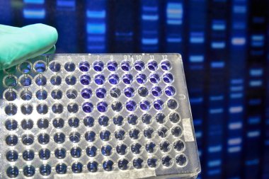 Dna testi laboratuvarda.