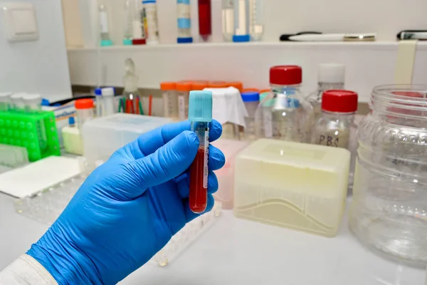 Laboratory study of blood. — Stock Photo, Image