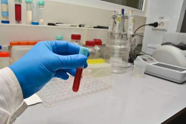 Examen en laboratoire d'un échantillon de sang . — Photo