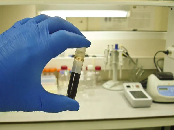 Blood test in the laboratory. — Stock Photo, Image