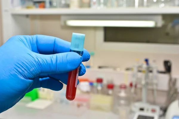 Análisis de sangre en el laboratorio . —  Fotos de Stock