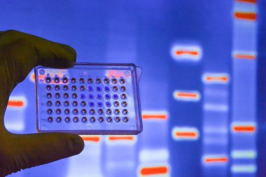 Laboratuar Dna testi.