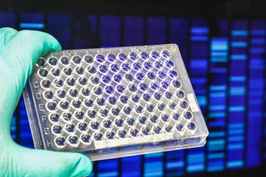 Laboratuar Dna testi.