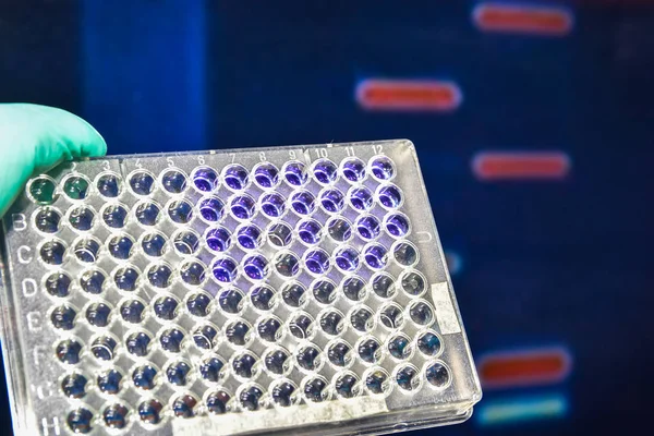 Laboratory DNA testing. — Stock Photo, Image
