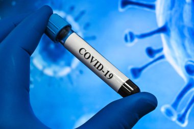 Covid-19 'a sebep olan koronavirüs için kan testi. Sars-Cov-2 testi için bir kan örneği..