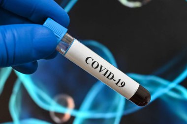 Covid-19 'a sebep olan koronavirüs için kan testi. Sars-Cov-2 testi için bir kan örneği..