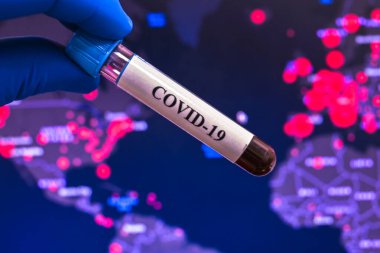 Covid-19 'a sebep olan koronavirüs için kan testi. Sars-Cov-2 testi için bir kan örneği..