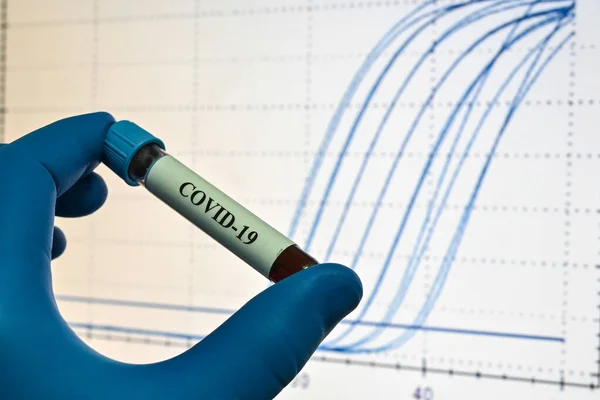 Krevní Testy Koronavirus Který Způsobuje Covid Vzorek Krve Pro Testování — Stock fotografie