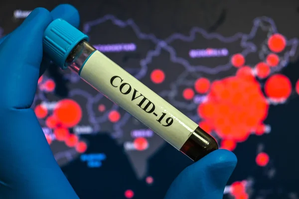 Blood Testing Coronavirus Causes Covid Blood Sample Testing Sars Cov — Stock Photo, Image