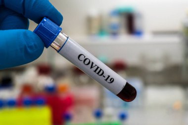 COVID-19 üzerinde test ediliyor. Coronavirus SARS-CoV-2 tespiti için bir tüp kan..
