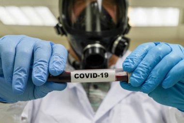 COVID-19 üzerinde test ediliyor. Coronavirus SARS-CoV-2 tespiti için bir tüp kan..