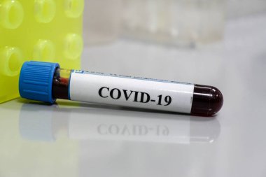 COVID-19 üzerinde test ediliyor. Coronavirus SARS-CoV-2 tespiti için bir tüp kan..